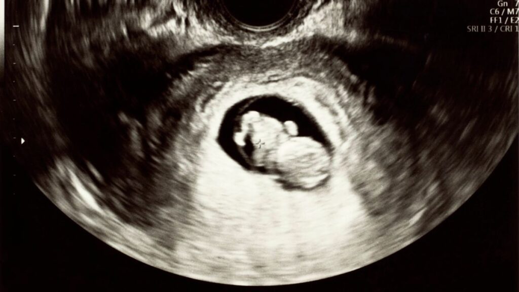 Künstliche Befruchtung: Die gefährliche Reise des ersten Lebens